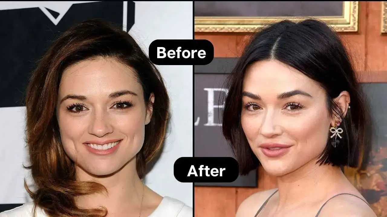 Aprenda todo sobre la cirugía plástica y las relaciones con Crystal Reed