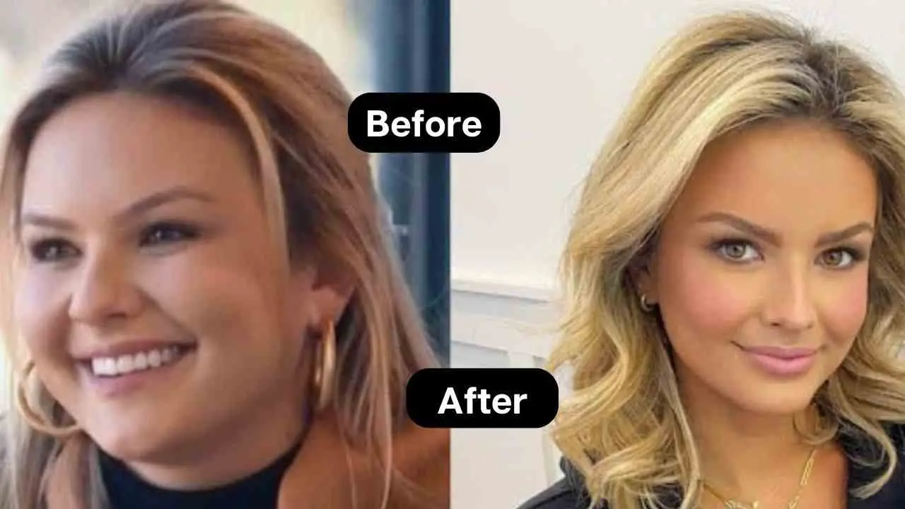 Conozca los secretos del viaje de pérdida de peso de Emmy Medder