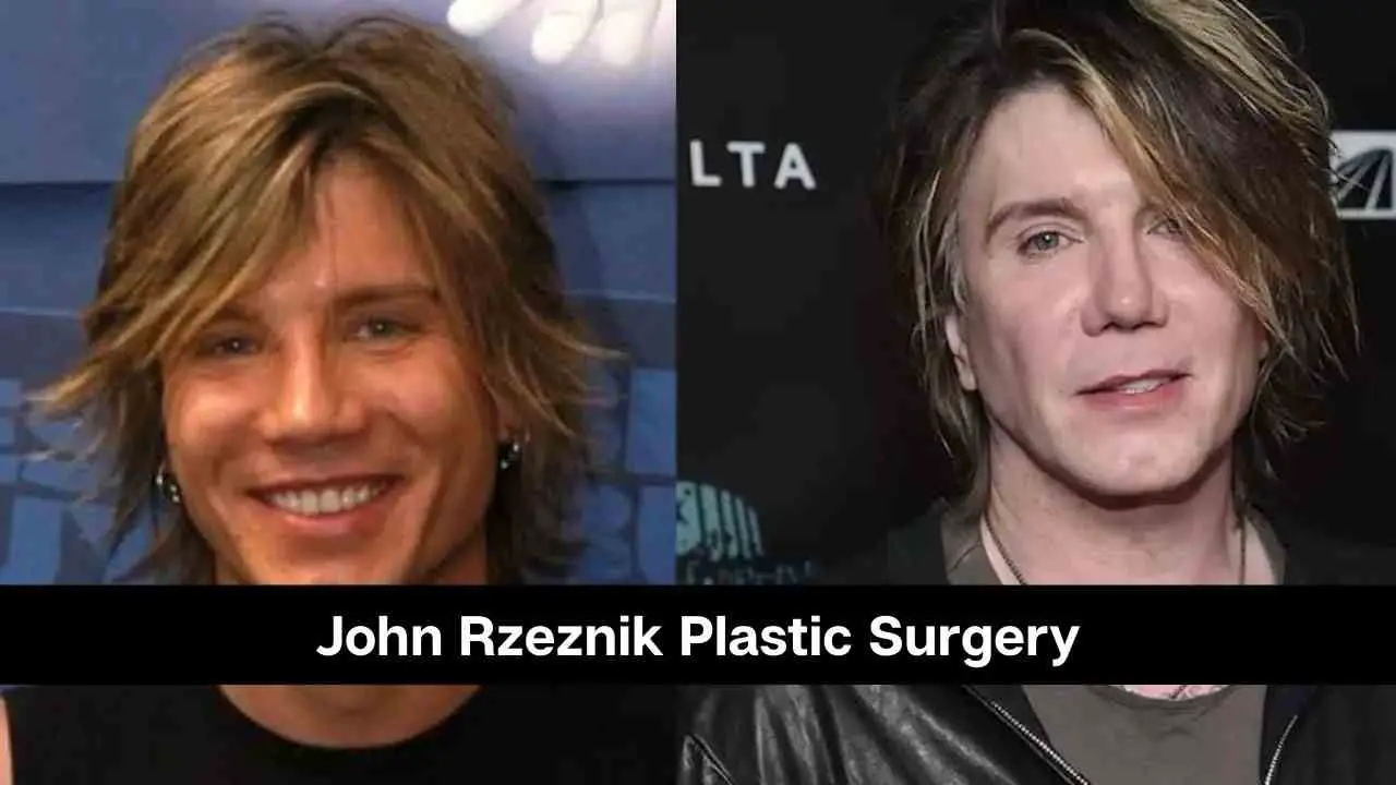 Conozca los secretos de la cirugía plástica de John Rzeznik – en detalle